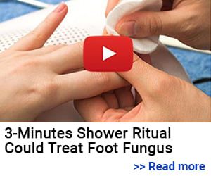 3 – Minutes Shower Ritual Could Treat Foot Fungus… Read More>> 3 – Minutes Shower Ritual Could Treat Foot Fungus… Read More>>