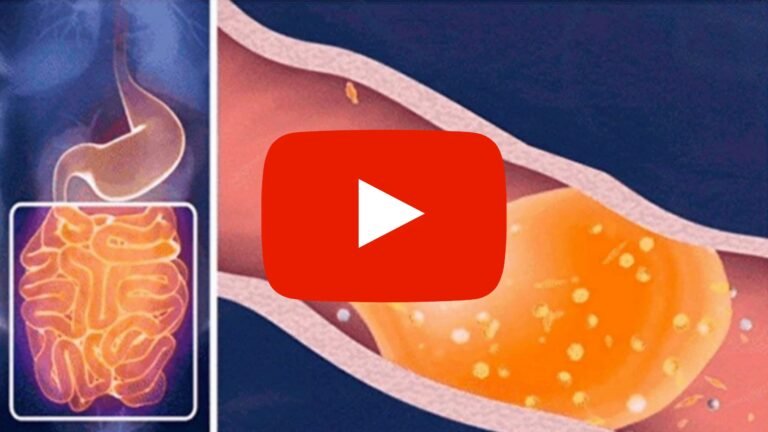 EXIPURE Reviews 2024: Does This Weight Loss Fat Burner Work? 1