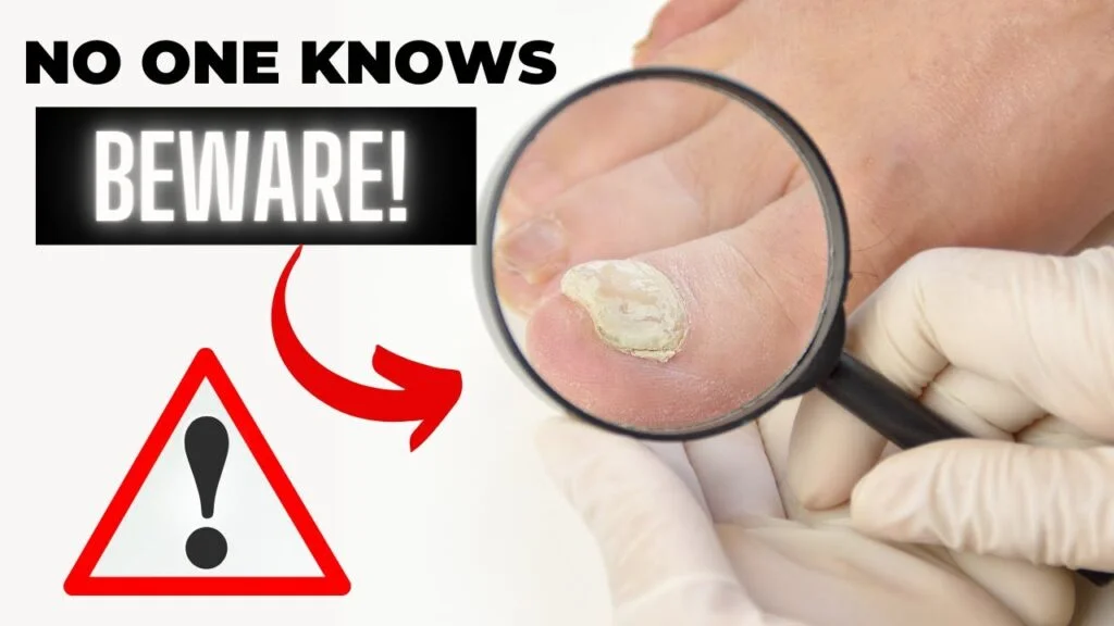Mycosyn Pro review – The best treatment for toenail fungus? Mycosyn Pro review - The best treatment for toenail fungus?