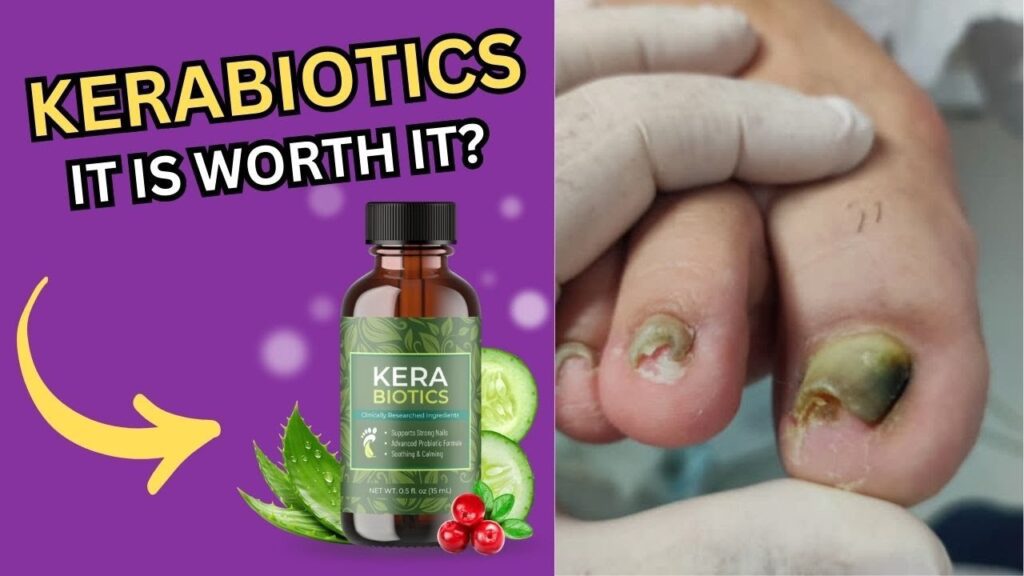 KeraBiotics Review 2024. KeraBiotics SHOCKING Warning! KeraBiotics Formula and Ingredients.