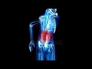 Back Pain What to Do