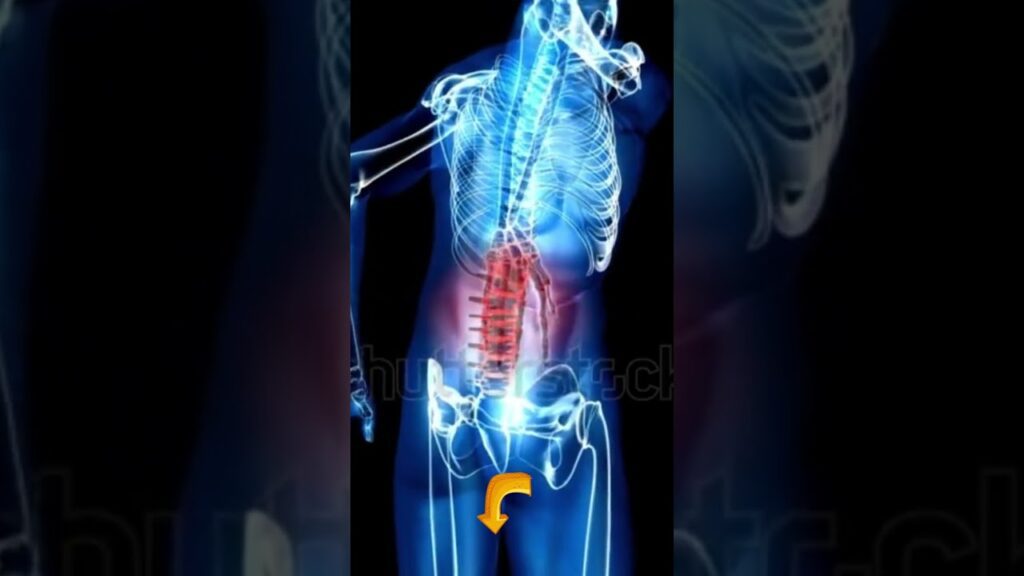 Back Pain What to Do #shorts